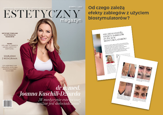 Od czego zależą efekty zabiegów z użyciem biostymulatorów